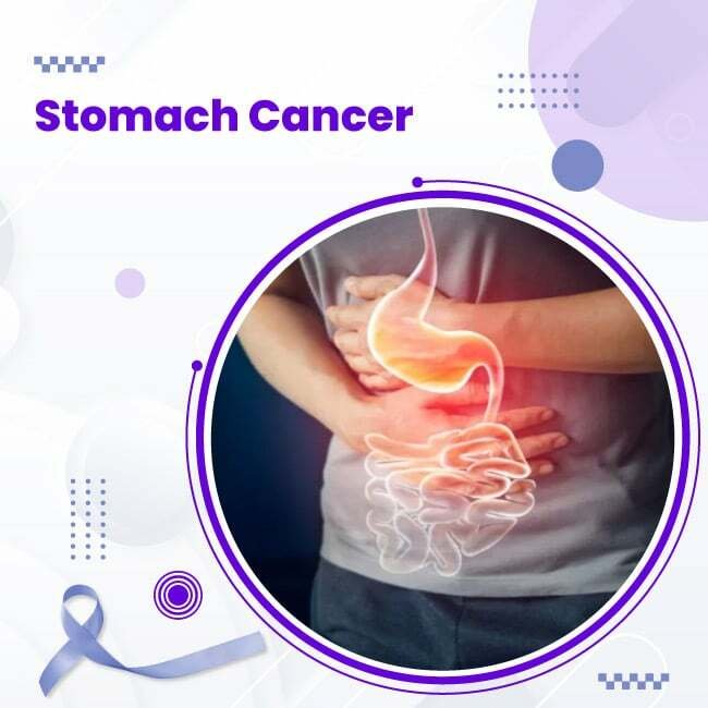 Stomach Cancer