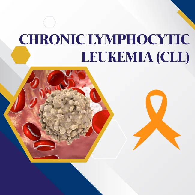 Chronic Lymphocytic Leukemia (CLL) Chronic Lymphocytic Leukemia