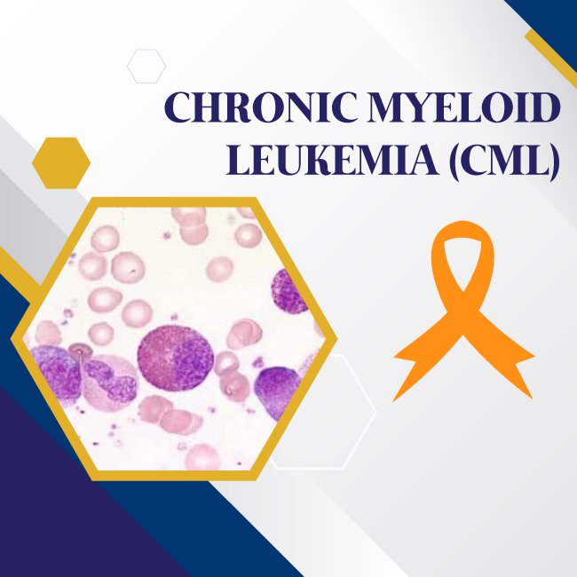 Chronic Myeloid Leukemia