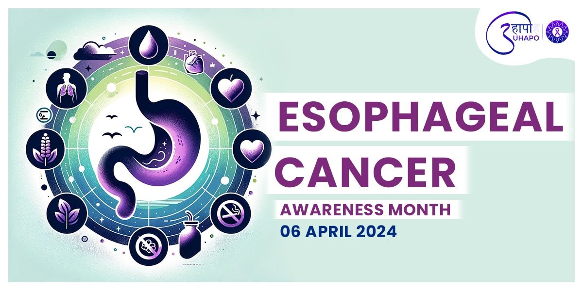 Preventing Esophageal Cancer