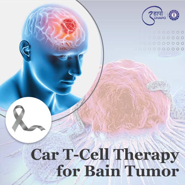 Car T Cell Therapy for Brain Tumor