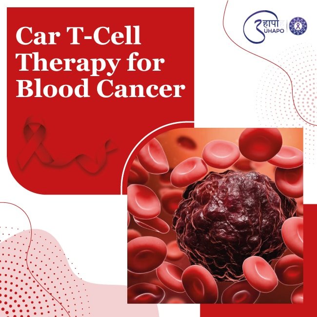 Car T Cell Therapy for Blood Cancer