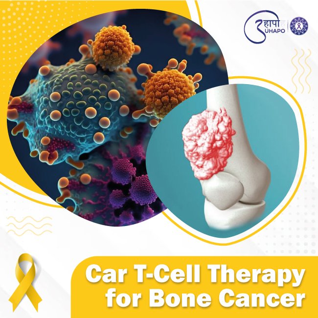 Car T Cell Therapy for Bone Cancer