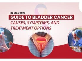 Guide to Bladder Cancer: Causes, Symptoms, and Treatment Options